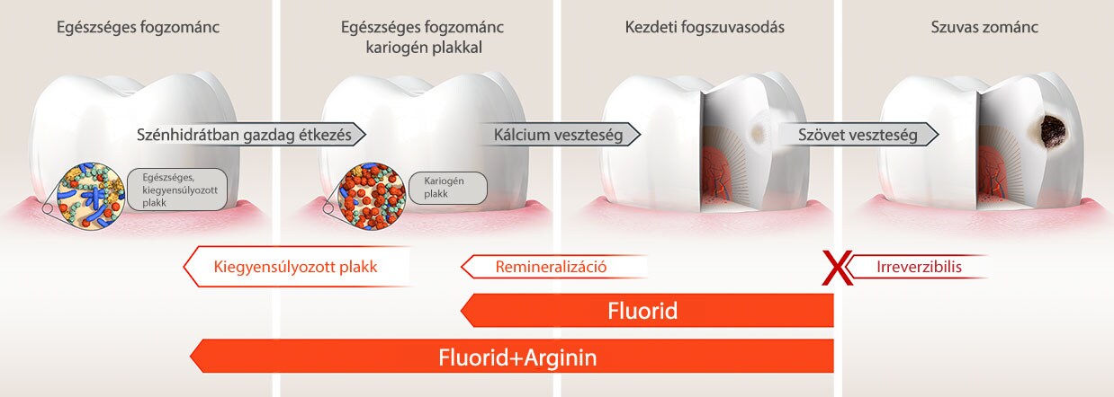 Kariogén plakk