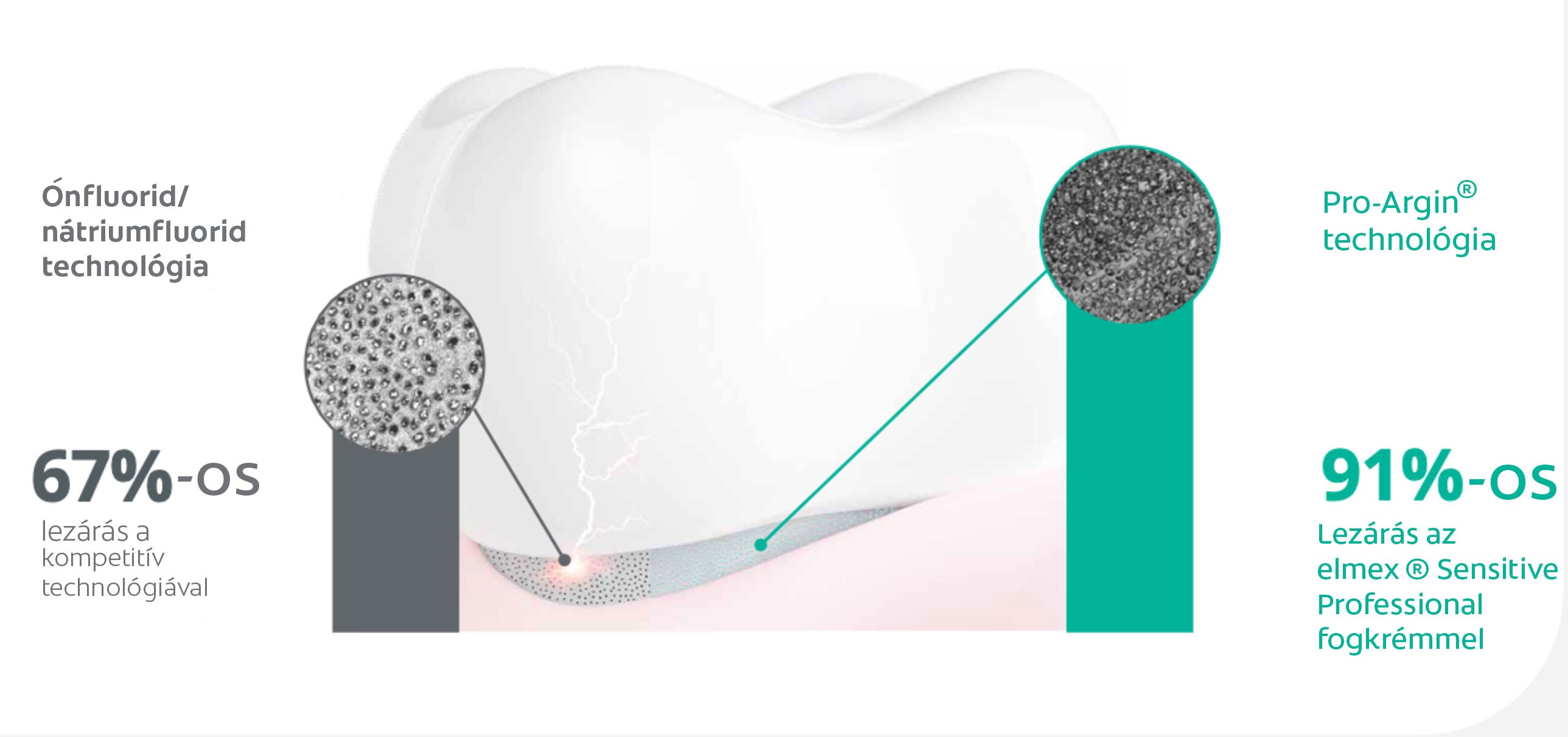 Kiemelt dentincsatorna lezárás vs versenytárs technológiák