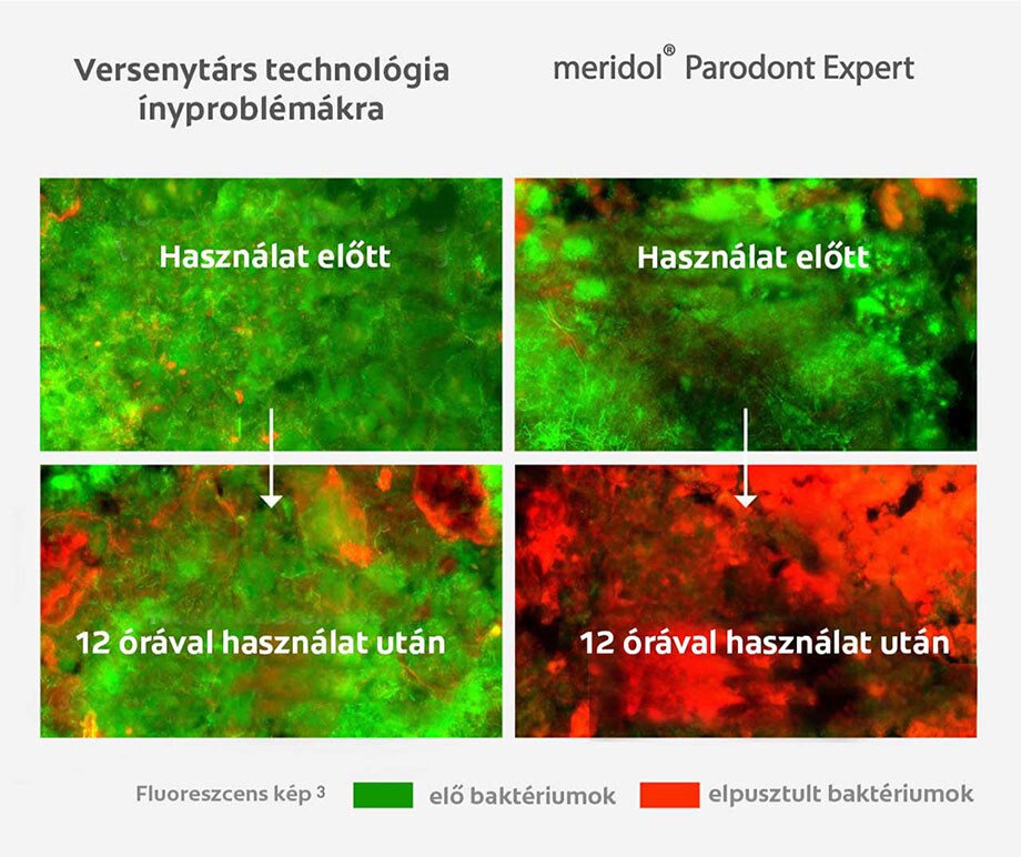 Kiemelkedő baktériumok elleni küzdelmet láthat